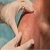 cosmetic-treatments
