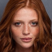 Beautiful Freckles