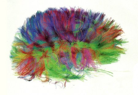 Brain Scan 5 - imagery, brain, nerves, circuitry, scan, axons, wide screen