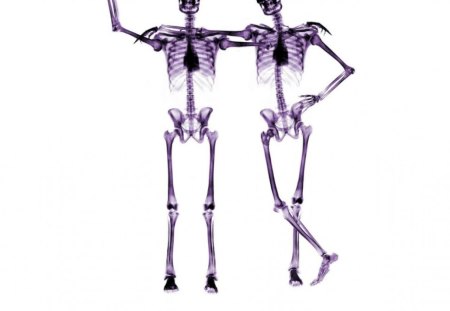 Buddies - x-ray, buddies, sketetons, friends, skeletons