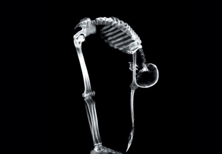 Gymnastic - skeleton, bent, x-ray, health