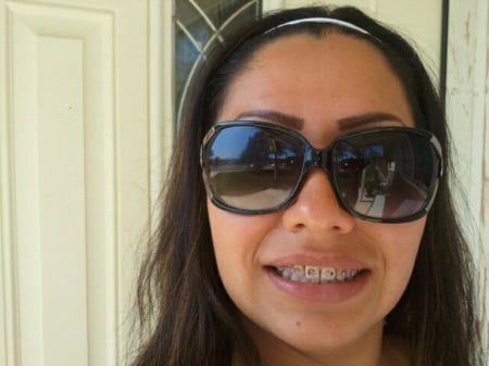 Braces - braces, sunglasses, self shot, smile