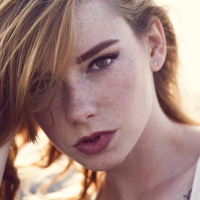 freckled girl