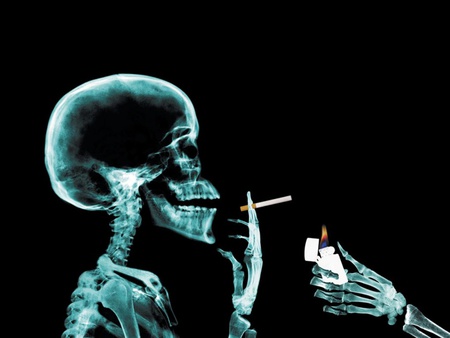 smoking x ray - cigarette, lighter, smoking-x-ray, x-ray, wallpaper, skeleton