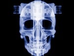 X-Ray Skull