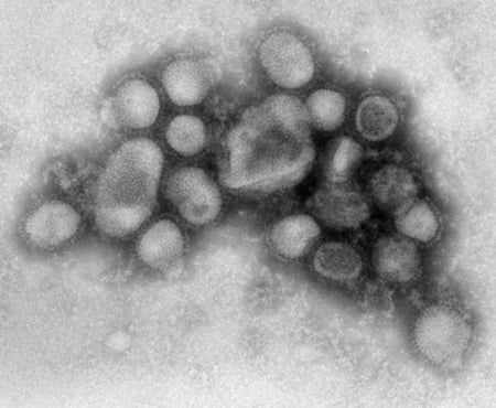 FLU - flu, h1n1, virus