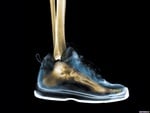 Foot X-Ray