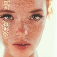 Freckles