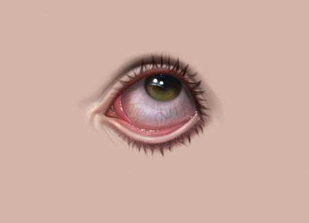 Eye