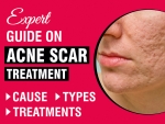 Acne Scar Treatment Guide By Expert Dermatologists