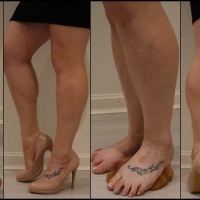 Legs and Heels