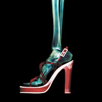 Heels Xray