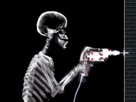 x-ray Drilling - skull, drill, drilling, x-ray, skeleton