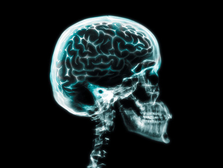 x-ray Head - skeleton, x-ray, skull