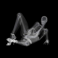 X-Ray Girl