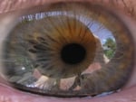 My Eye